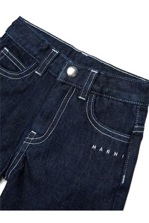 Pantaloncini con cuciture a contrasto MARNI KIDS | M01664M00WH0M01